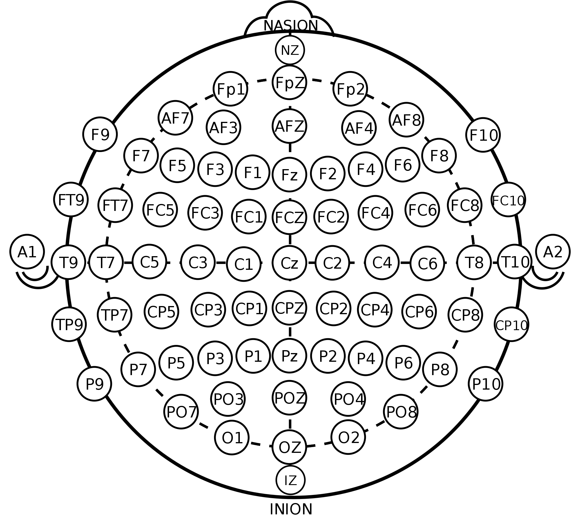 2000px-International_10-20_system_for_EEG-MCN.svg.png