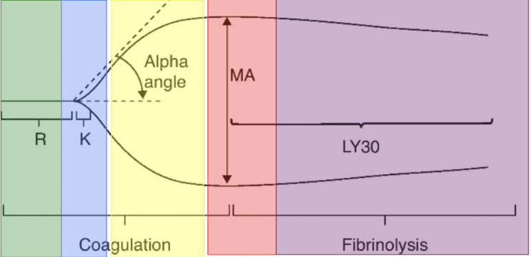 Teg Testing Resus: Thromboelastography (TEG) in Trauma Resuscitation — University ...