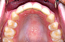 case1c-after.jpg