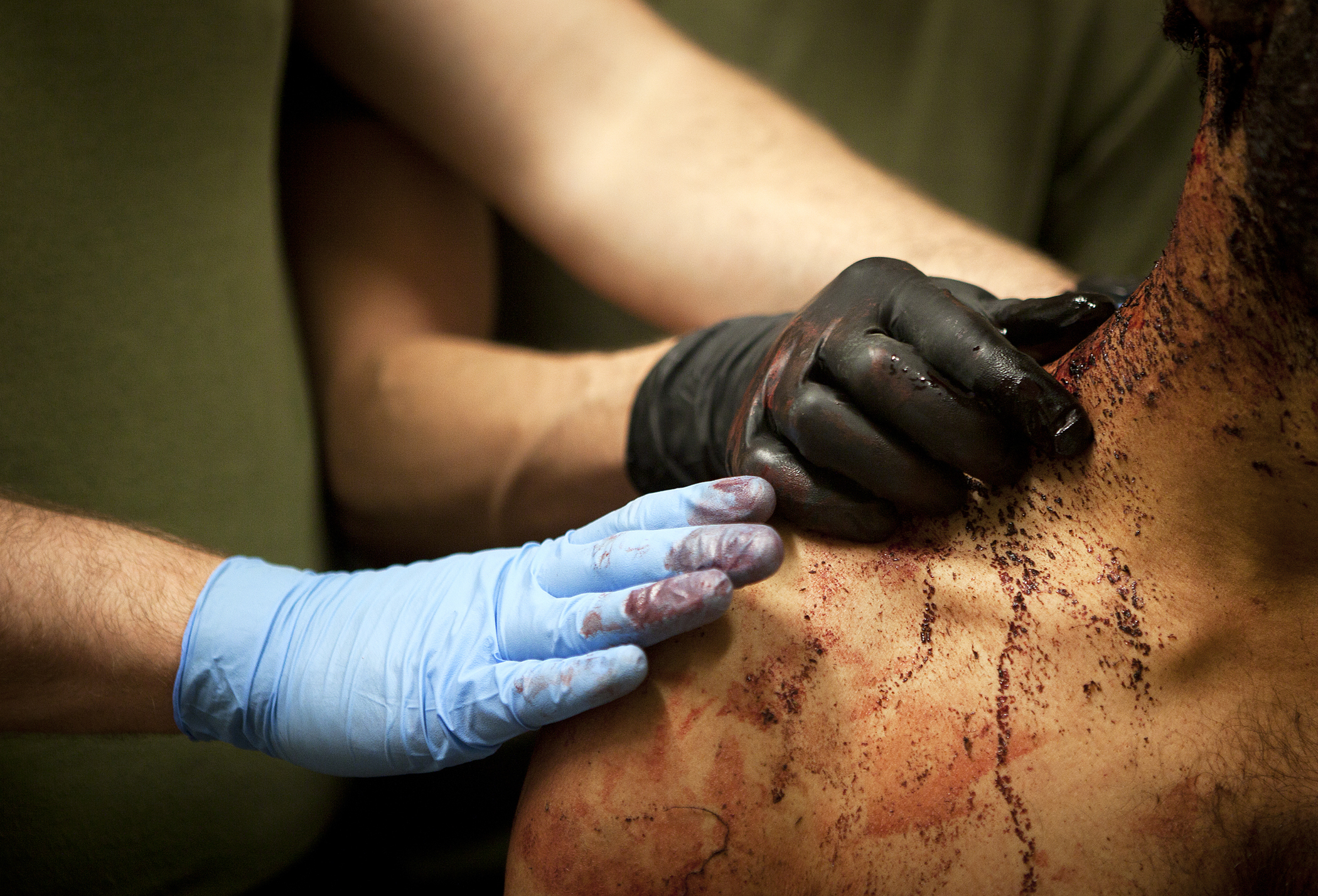 U.S. forces treat Afghans wounded by suicide bomber