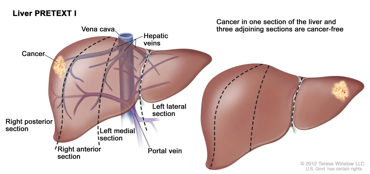 Liver PRETEXT I