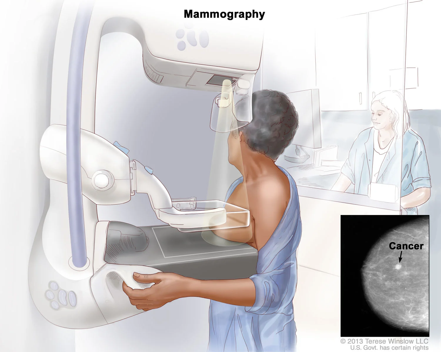 mammography.jpg