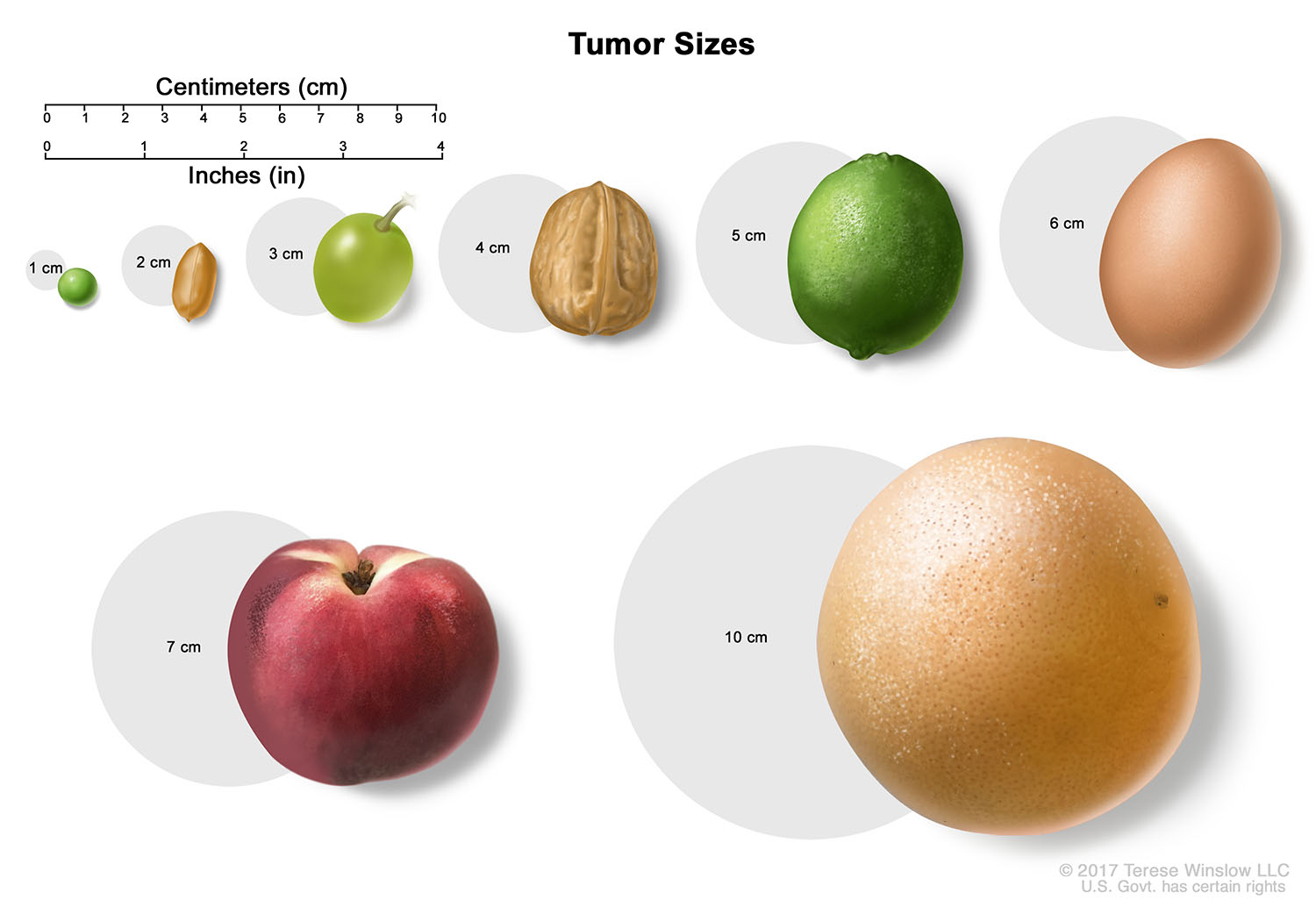 Tumor Sizes - Centimeters/Inches (1 - 10 cm) © 2017