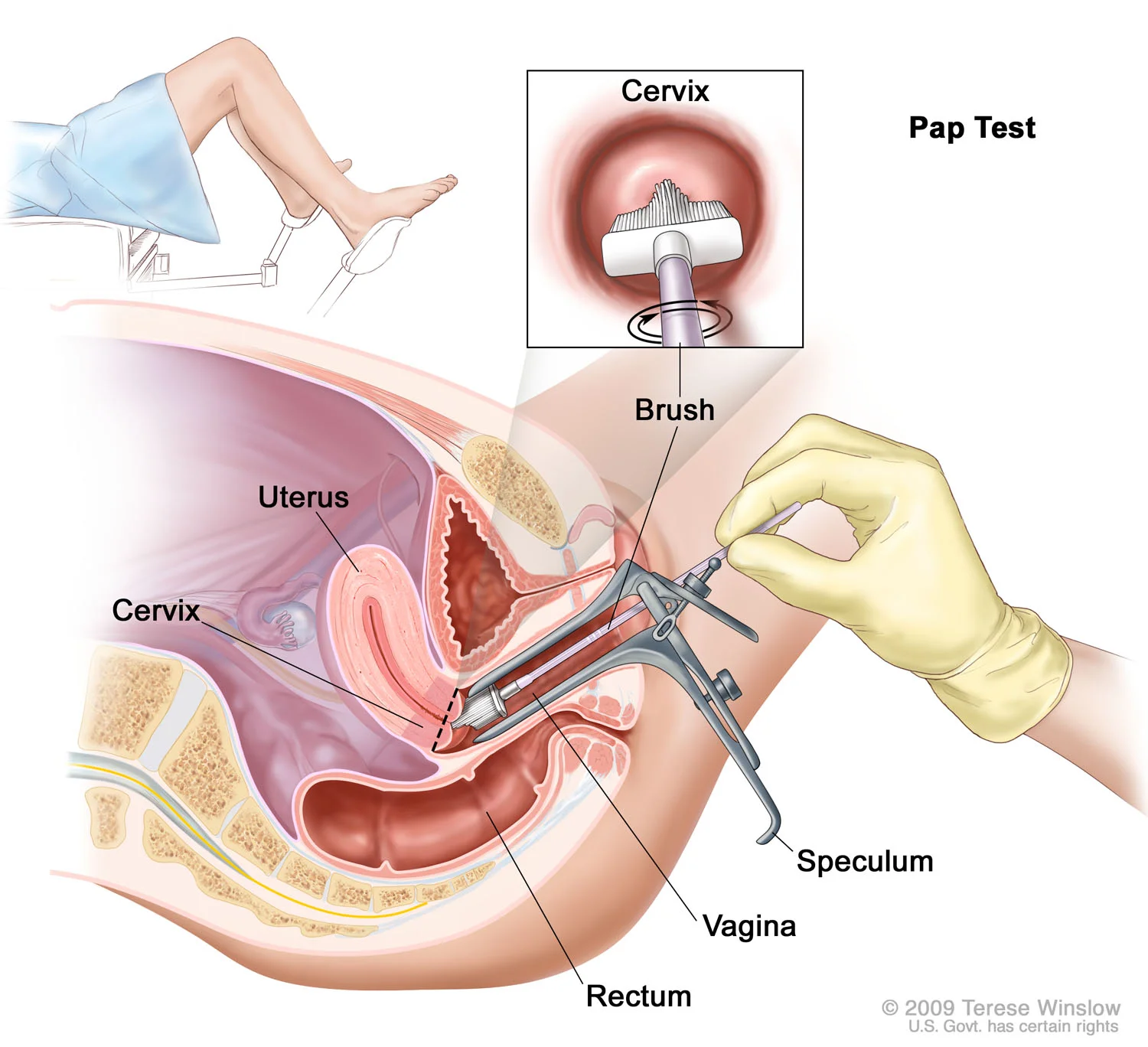 Pap Test
