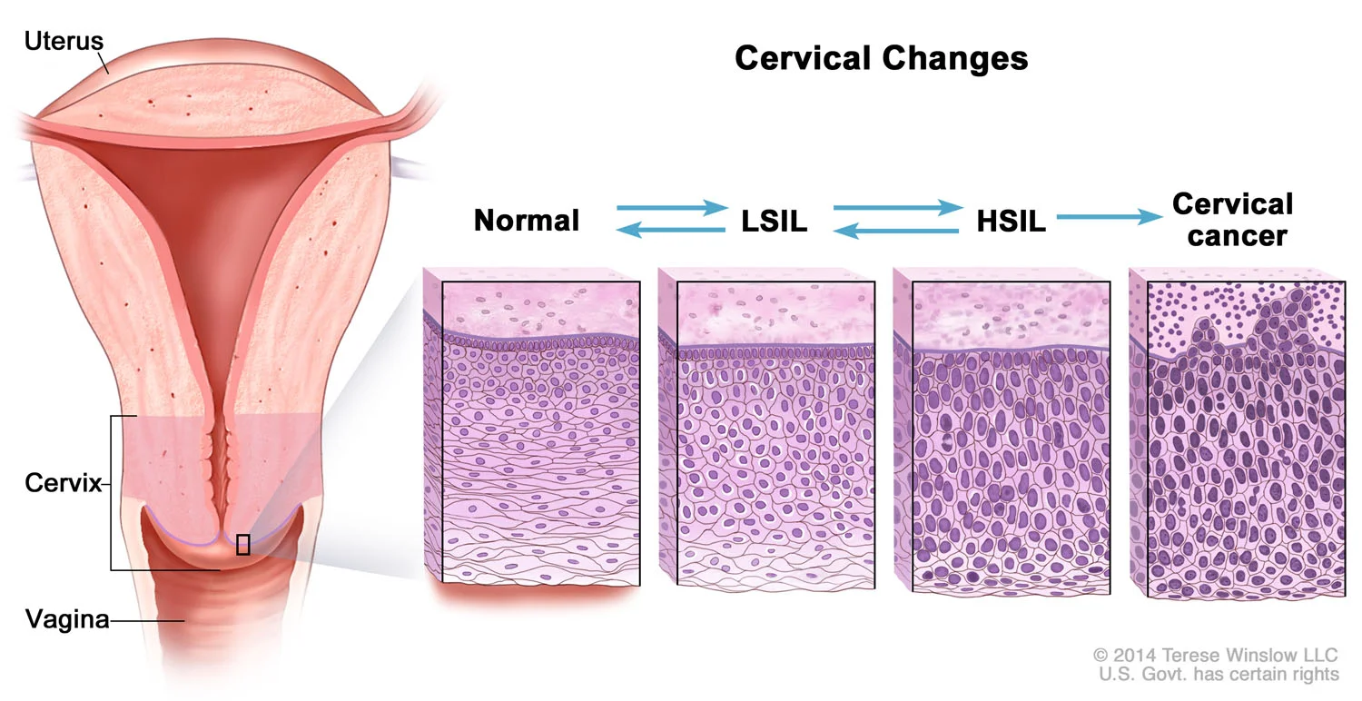 Cervical Changes