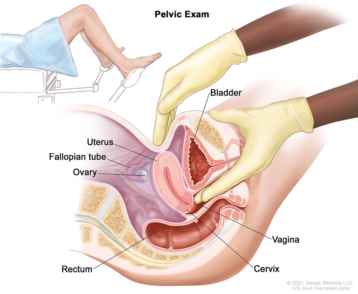 Pelvic Exam 2021