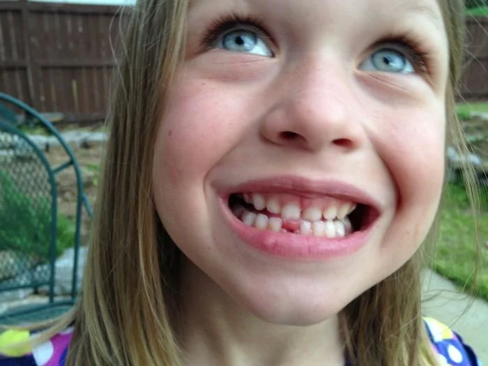 lost tooth 01.jpg