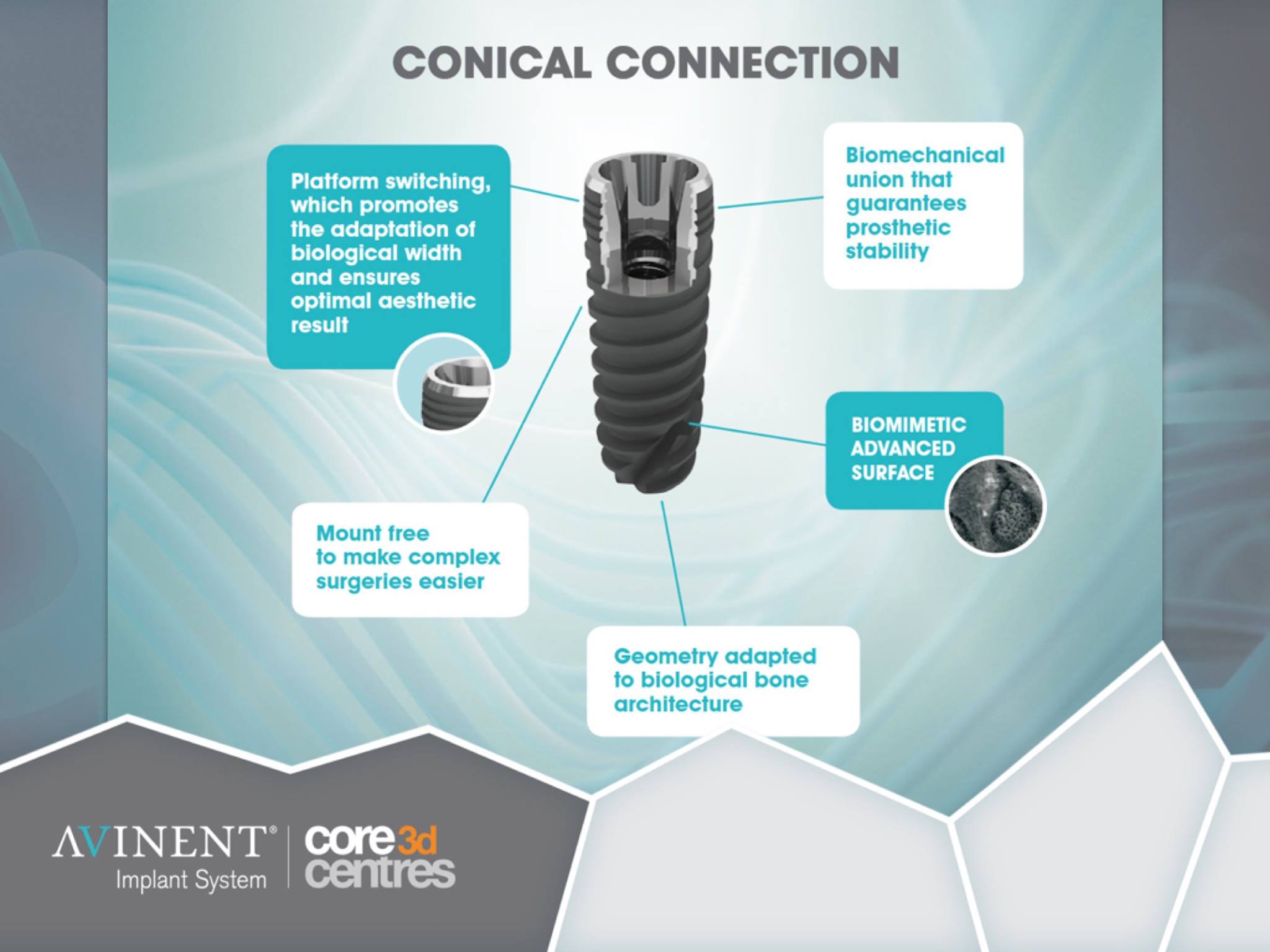 Avinent Conical Connection.jpg
