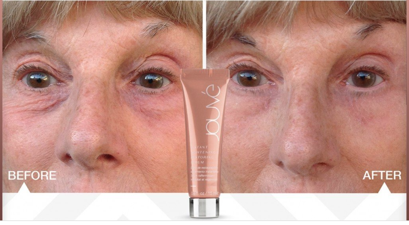 instant tightening cream