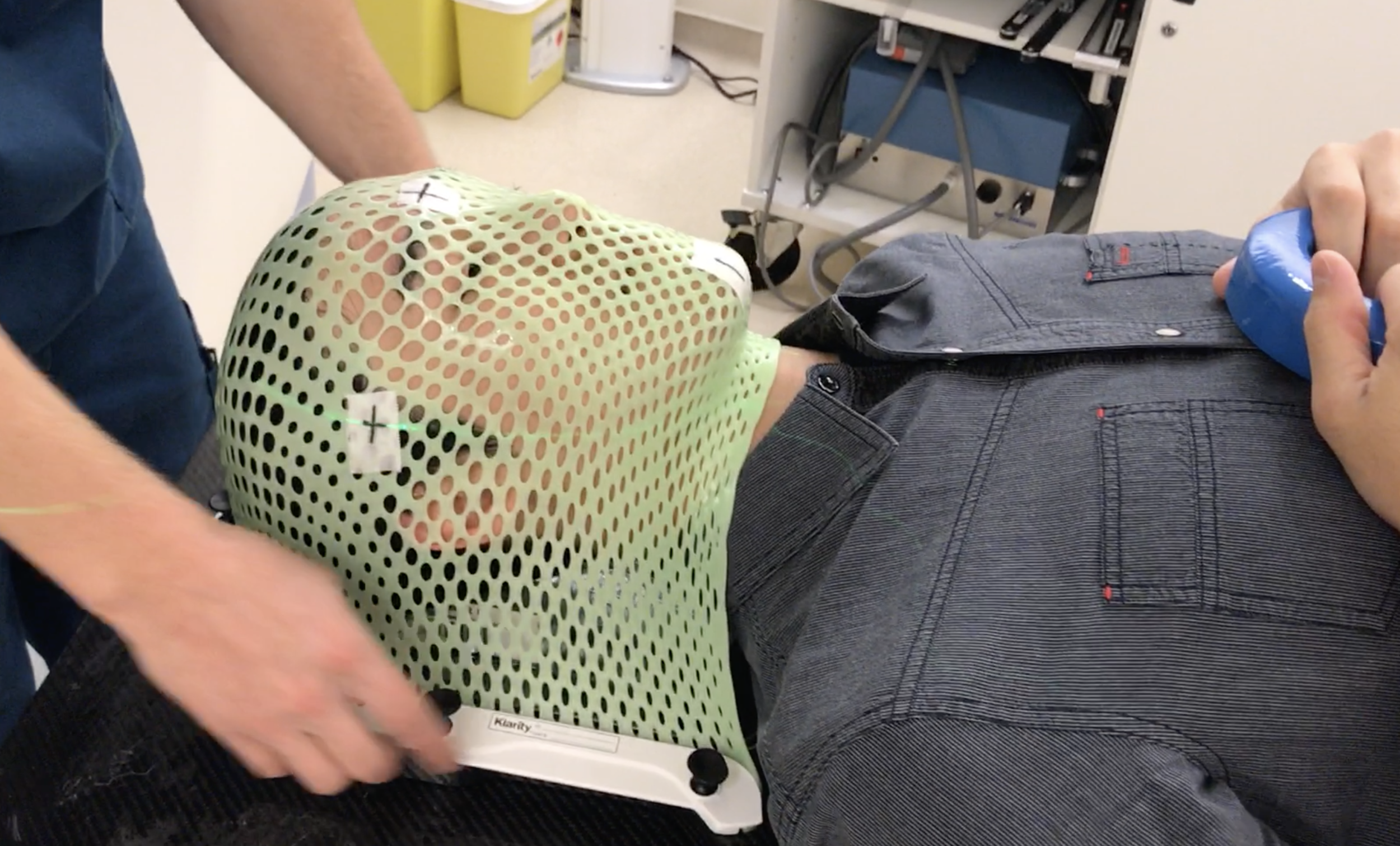 I experienced the creation of a proton therapy immobilization mask to understand the patient experience. - Research visit to the Chicago Proton Center