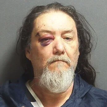 Injured man facing charges for public intox and battery to officer 