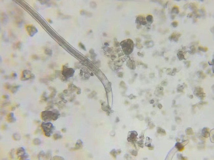 Ever wonder if your purchase of live beneficials is legit? I was super curious, so I popped a sample of the beneficial nematodes I purchased under the microscope. I was thrilled to see these amazing microbes alive and well.

While we have seen drasti