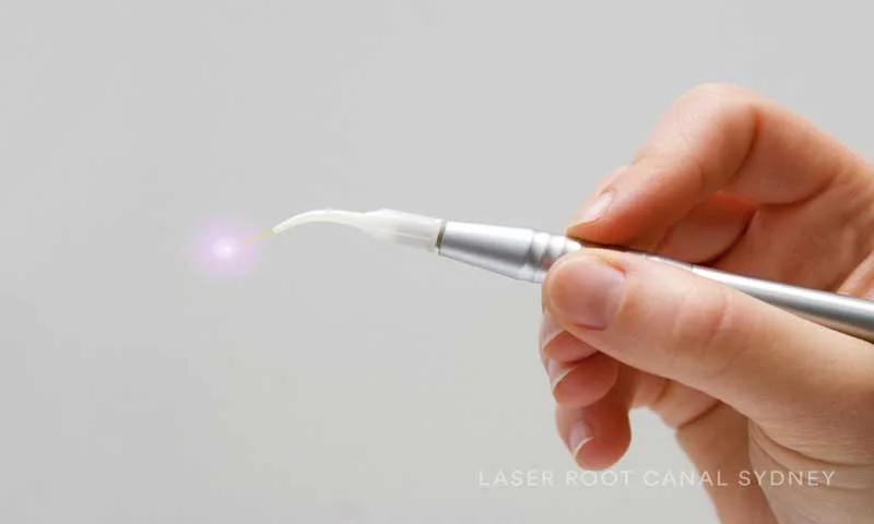 © Laser Root Canal Sydney Instrument.jpg
