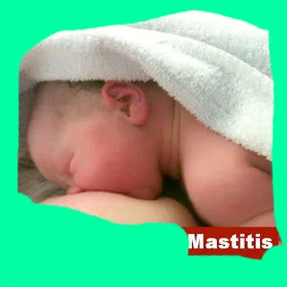 Extra thick sanitary pads