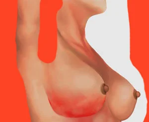 Plastic Water Bottle 