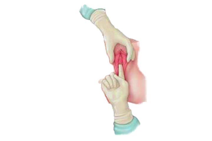 vaginal exam image.jpg