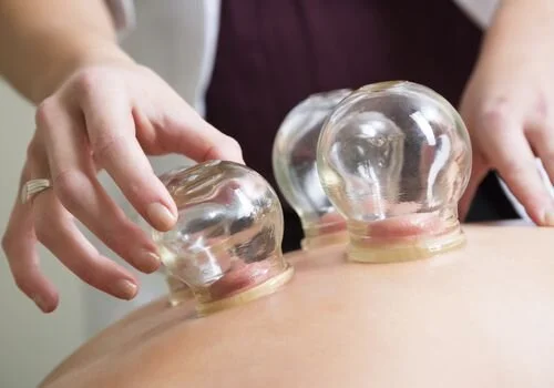 So what's CUPPING? 