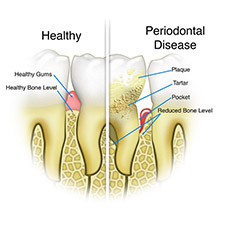 gum treatments .jpg
