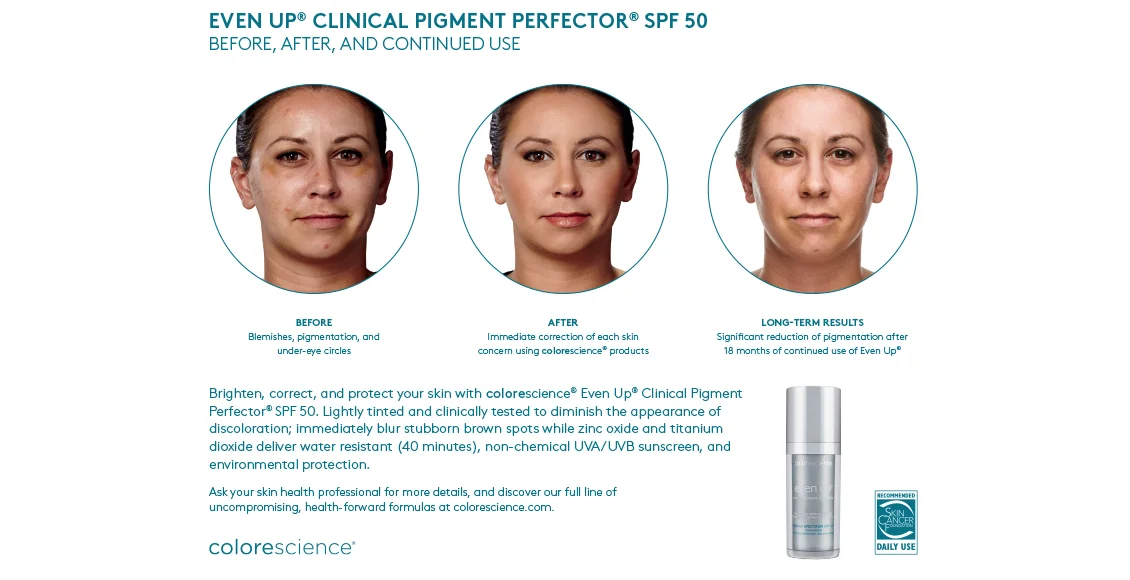 Colorescience-even-up-Before-and-After-Picture.jpg