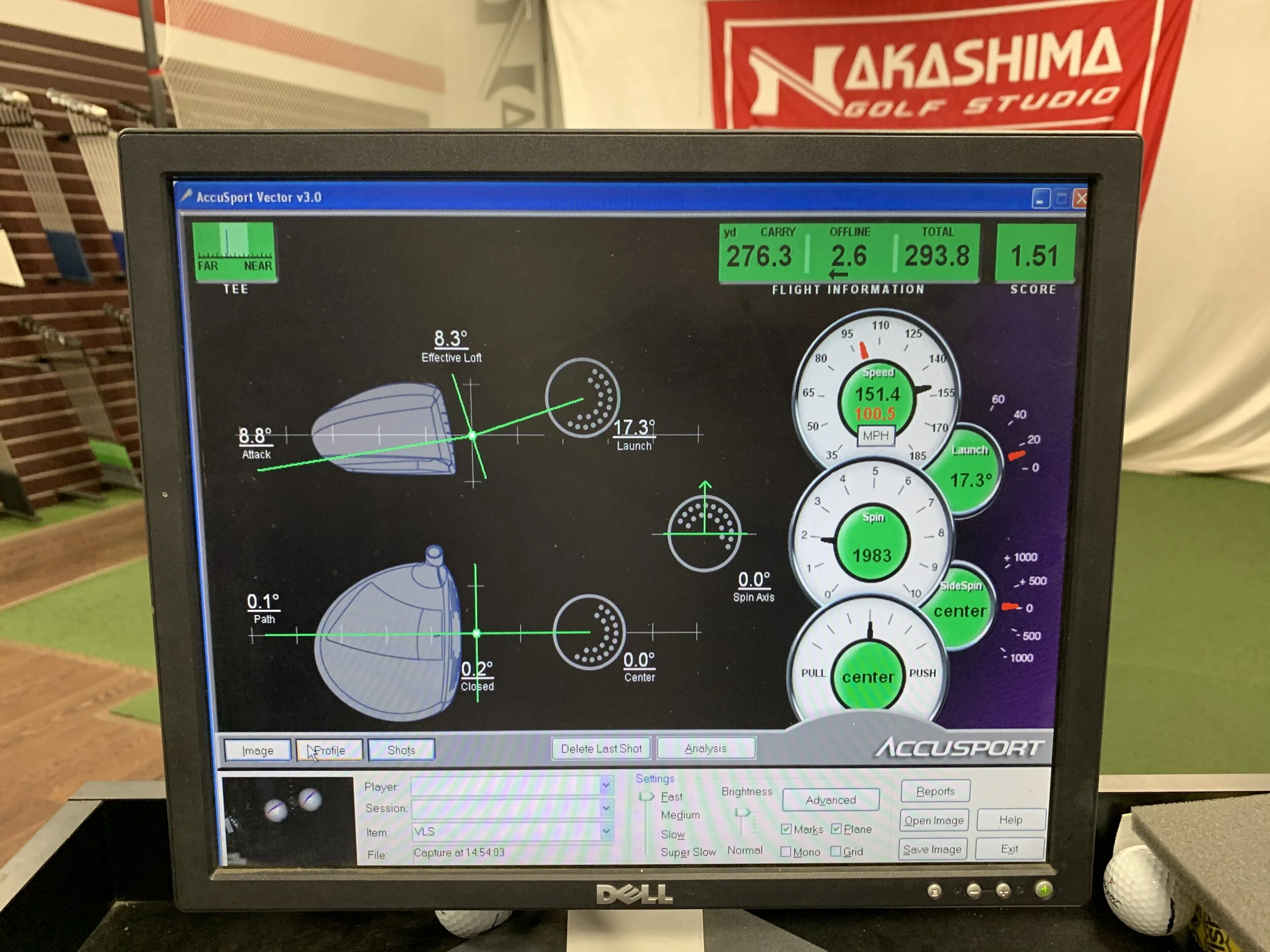 What’s in the Bag? 