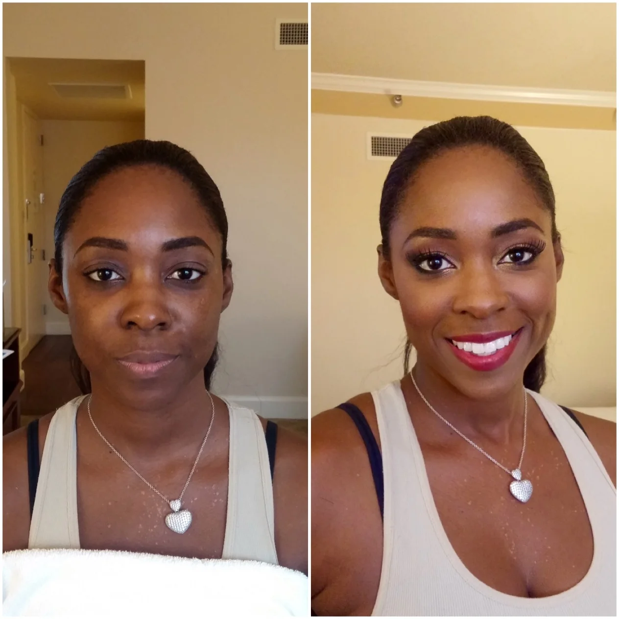 Before & After - #02