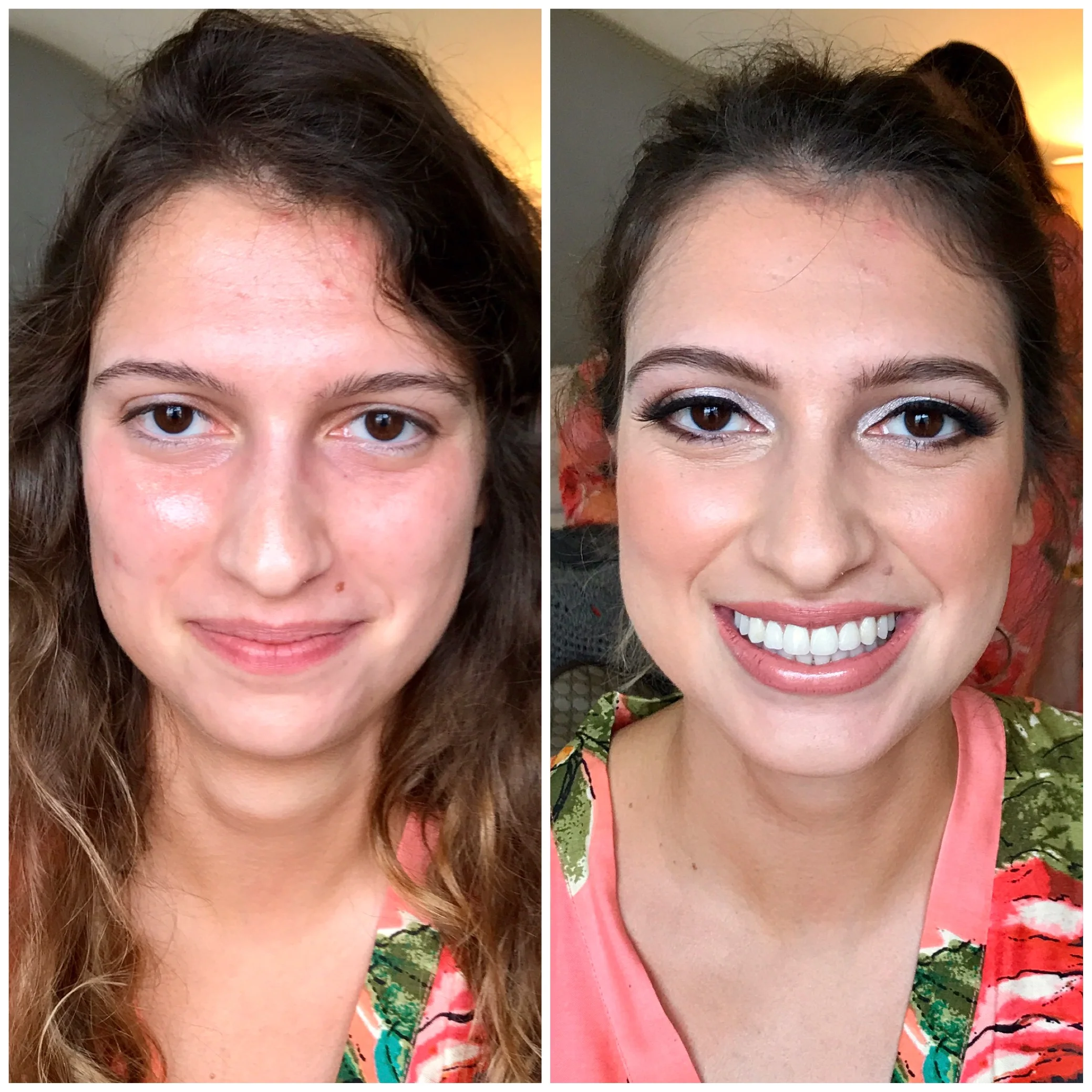 Before & After - #05 