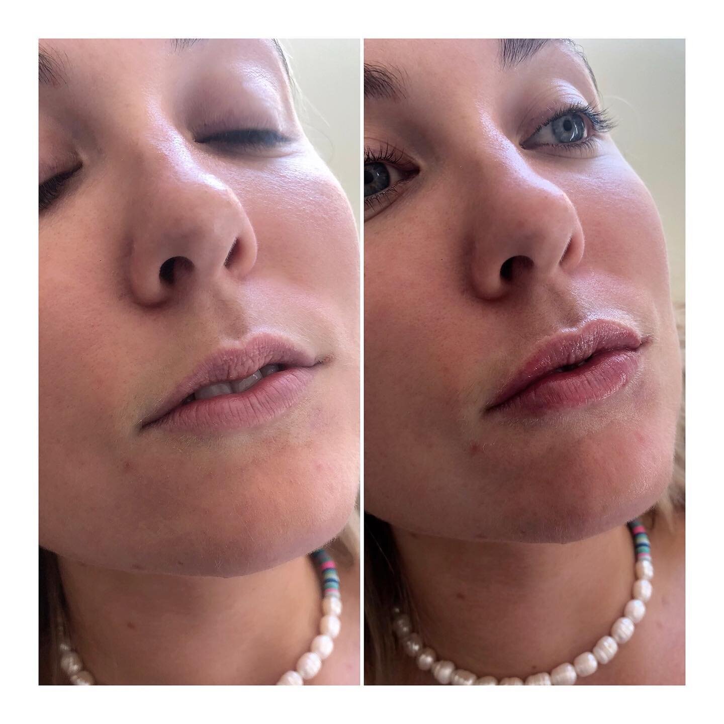 👄💉💋