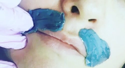 Woman having upper lip wax