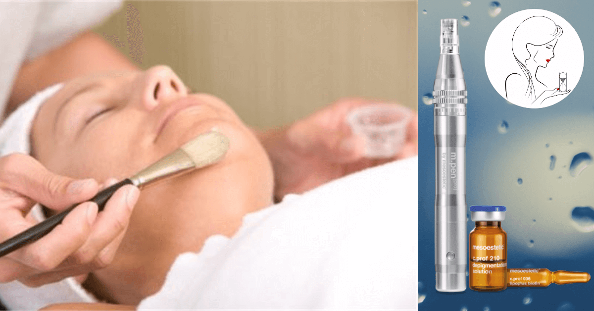 20 percent peels and microneedling.png
