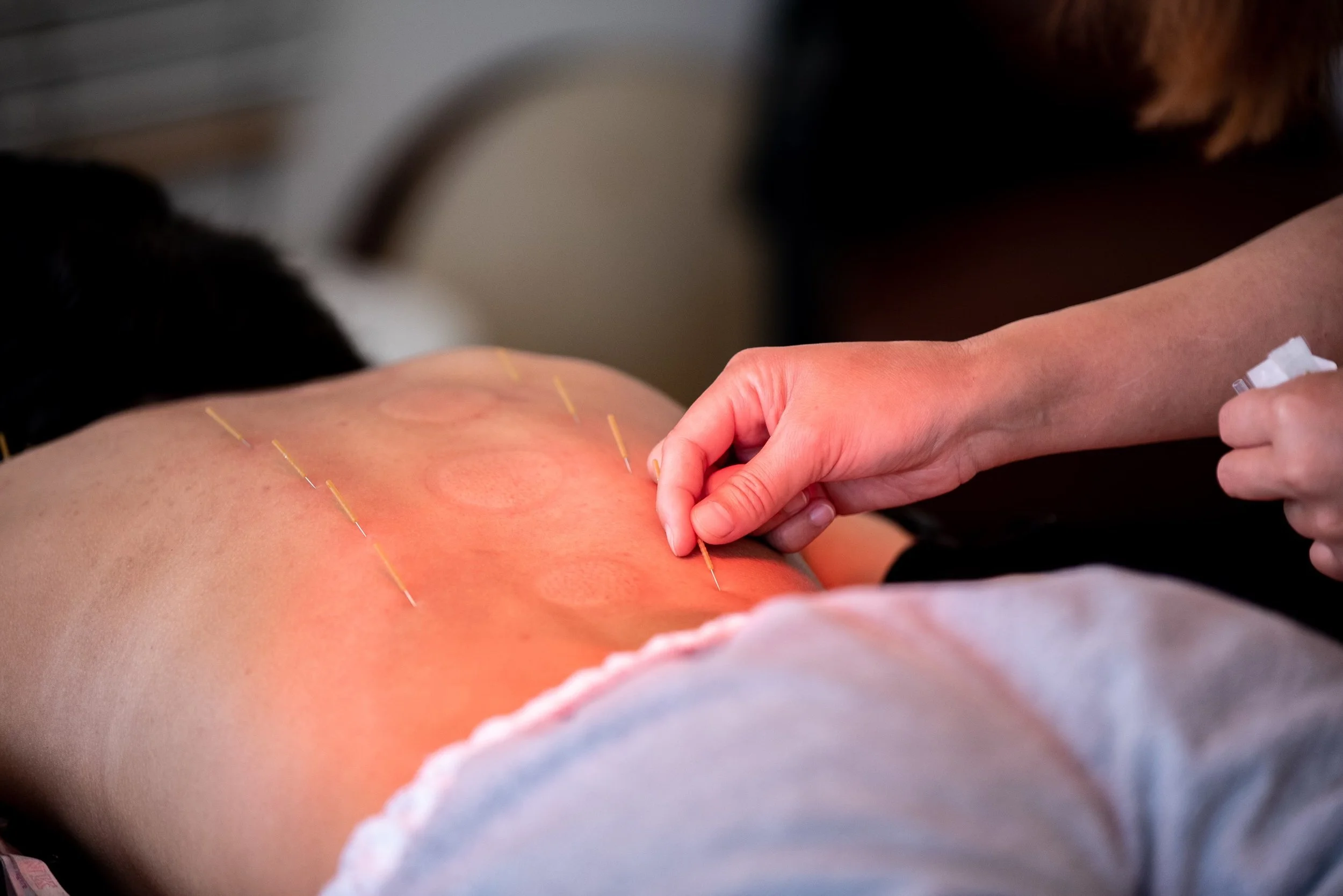 vibrant acupuncture by c sky photo-18.jpeg