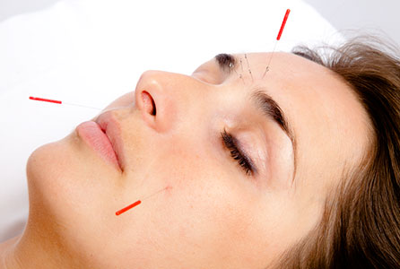 cosmetic acupuncture results before after