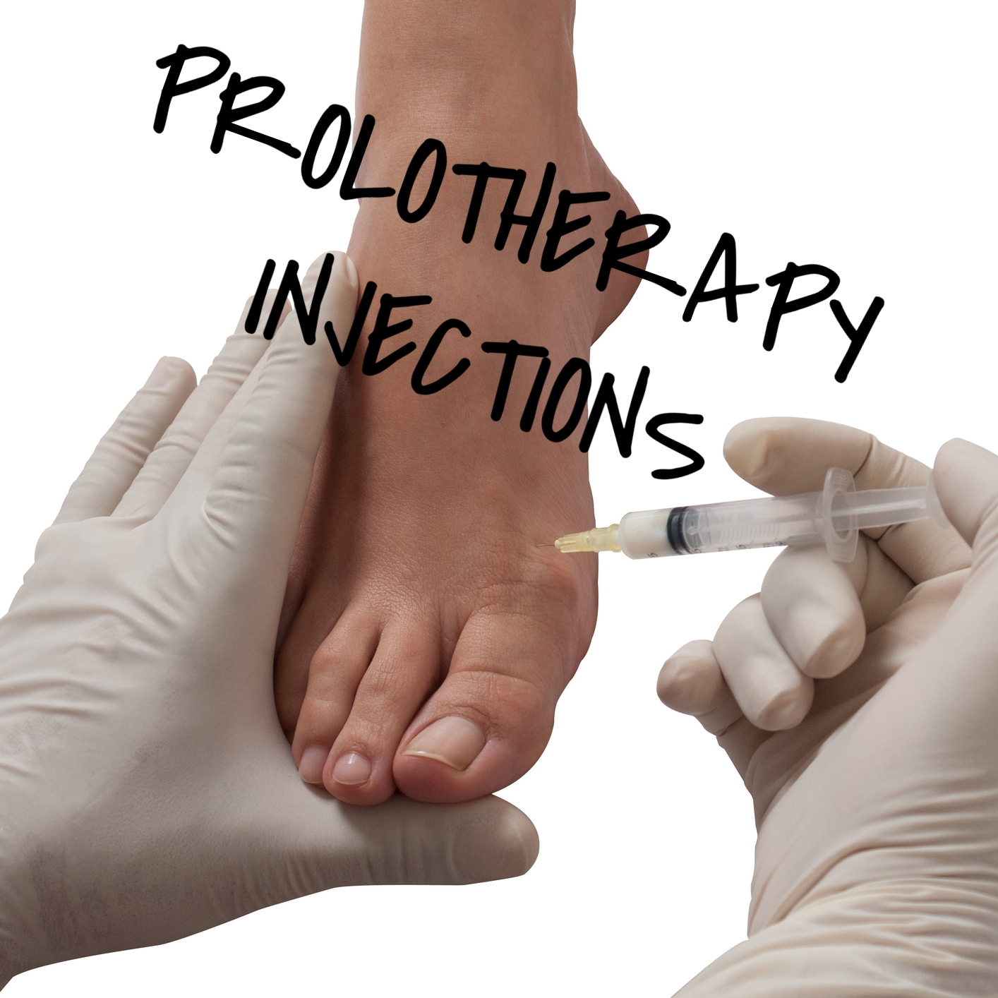 Prolotherapy Injections