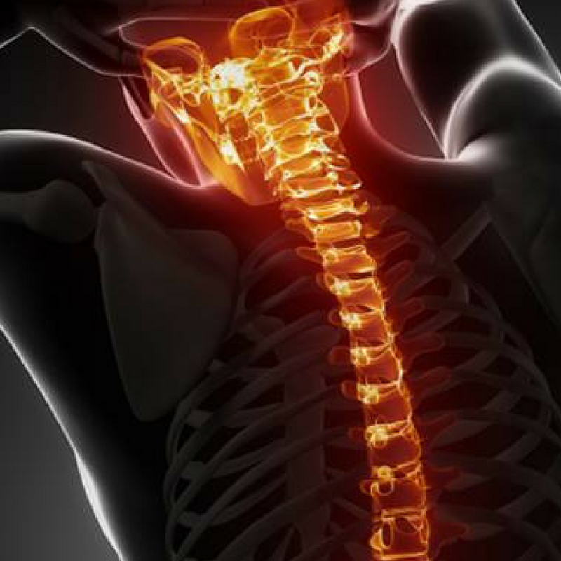 Neck Pain and Head Posture
