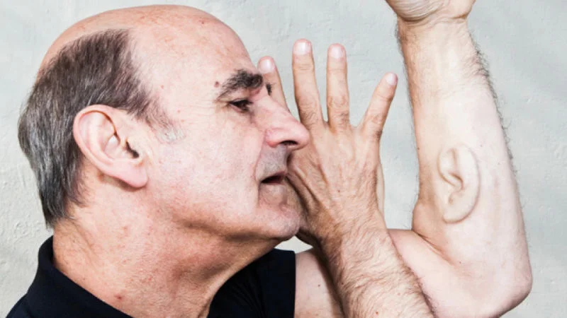 Stelarc, aki egy műfület ültettetett be a karjába