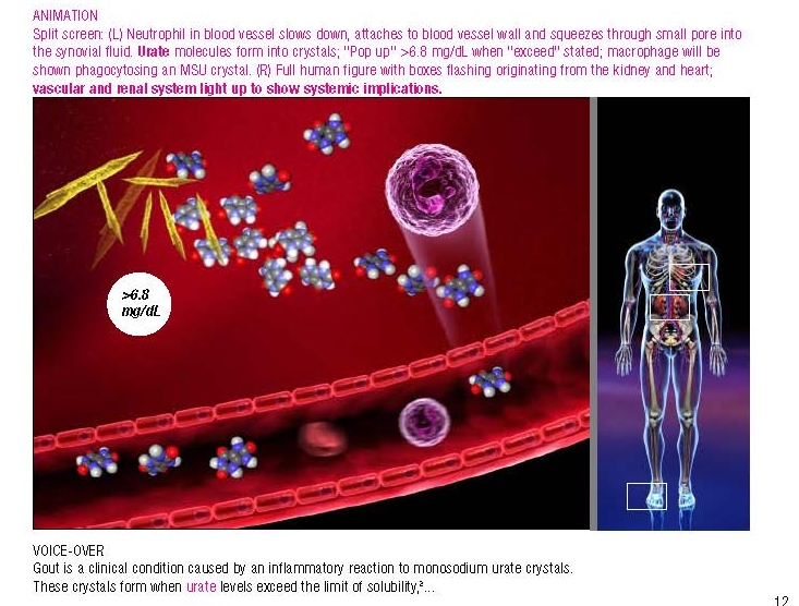 Hyperuricemia animated video (Copy)
