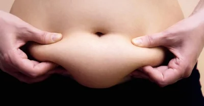 tummy tuck.jpg
