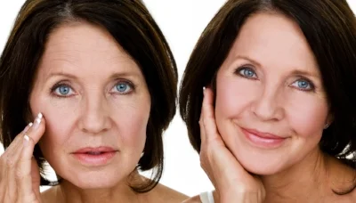 fillers.jpg