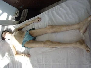 法輪功學員張忠在大慶監獄被迫害成一副枯骨架(明慧網)