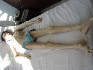張忠一副枯骨架被推出大慶監獄