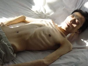 張忠一副枯骨架被推出大慶監獄