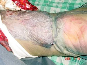法輪功學員郭士軍被哈爾濱長林子勞教所毒打致死的證據,遺體傷痕纍纍