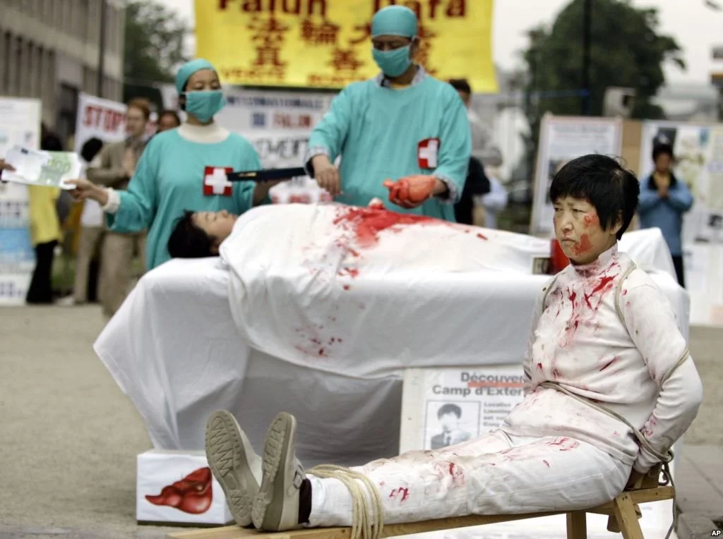 The CCP Prices Human Organs