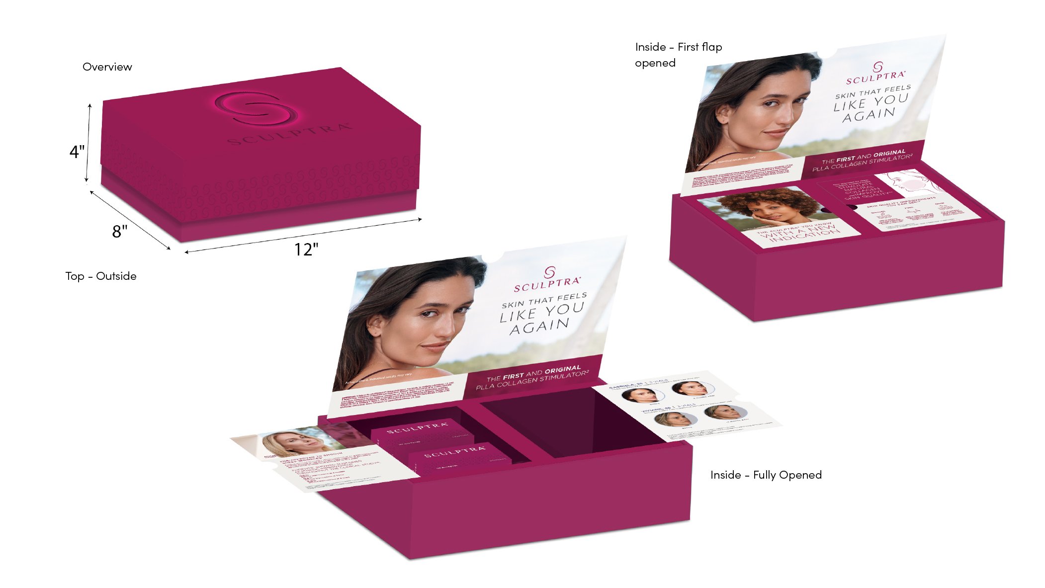 Sculptra Example.jpg