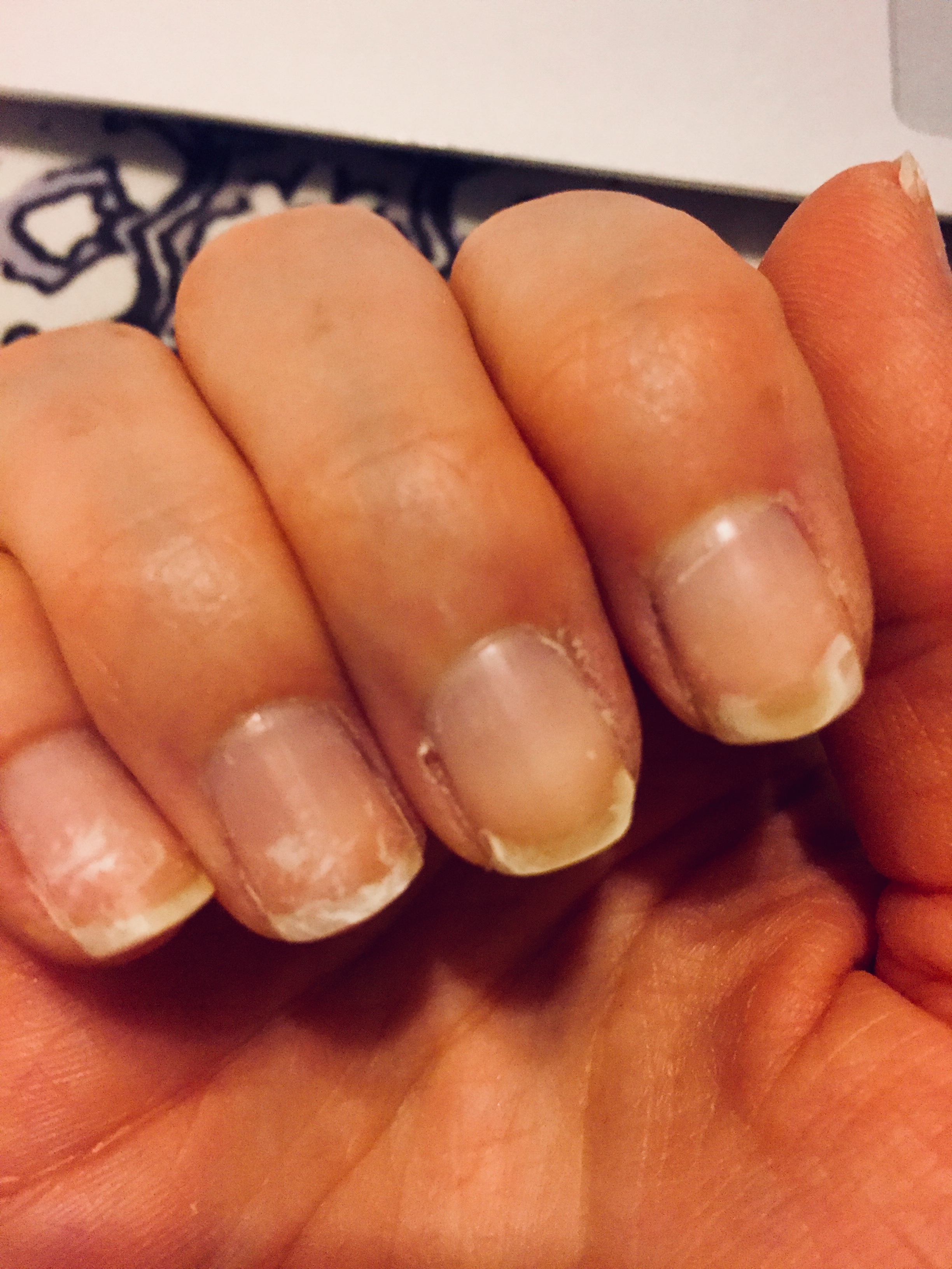 How to Strengthen Your Nails with Collagen | INJA Wellness