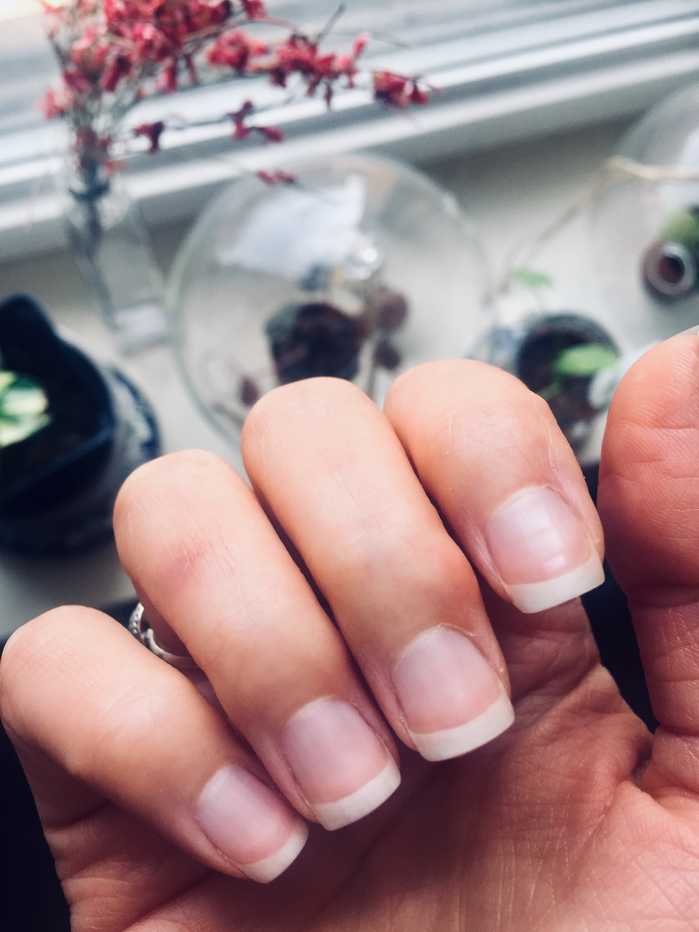 What Your Nails are Dying to Tell You — Composed Nutrition | Hormone, PCOS,  Fertility Nutrition | Registered Dietitian Nutritionist