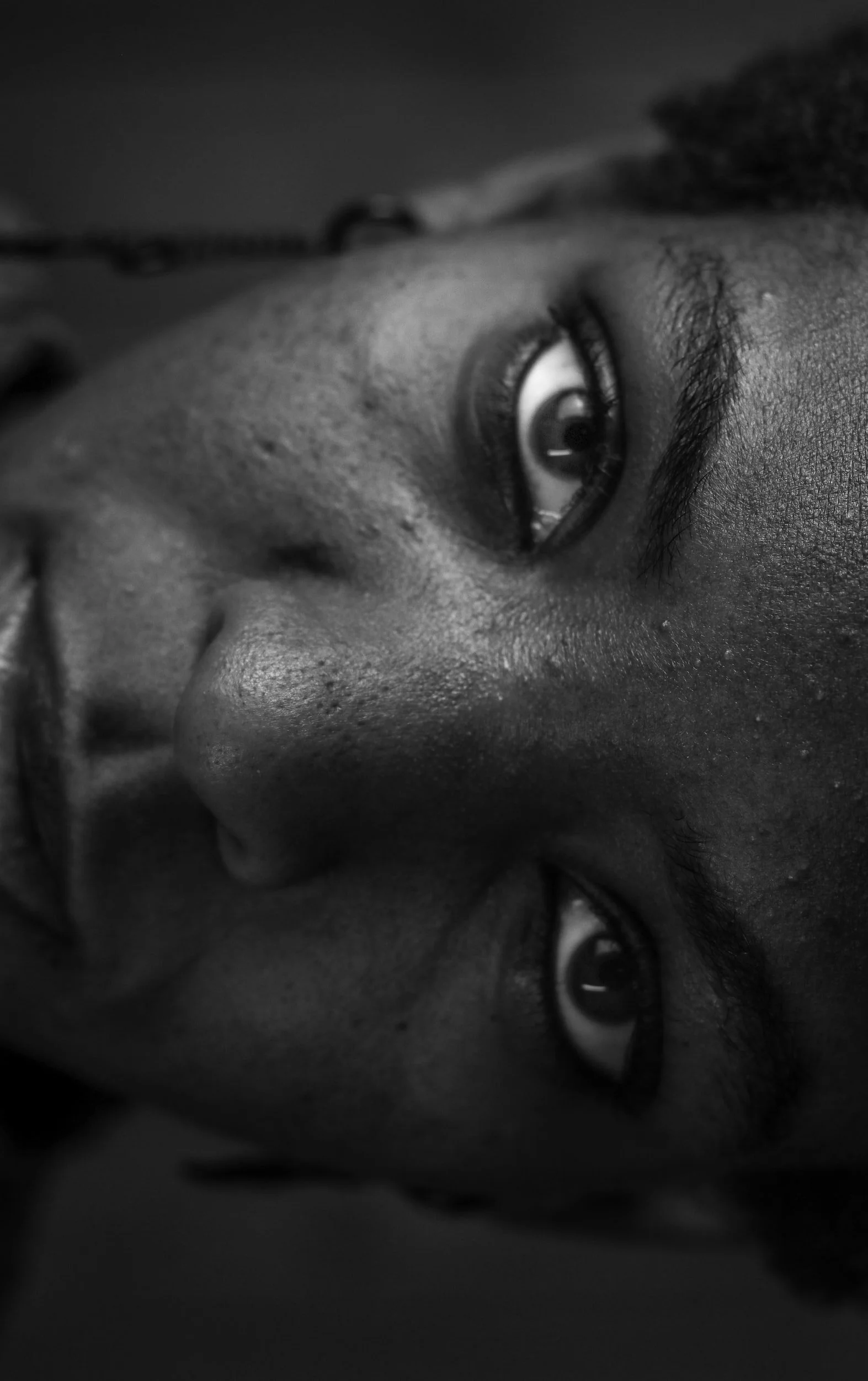 Why You're Getting Post Birth Control Acne and What to Do