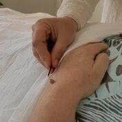 SB moxabustion.jpg