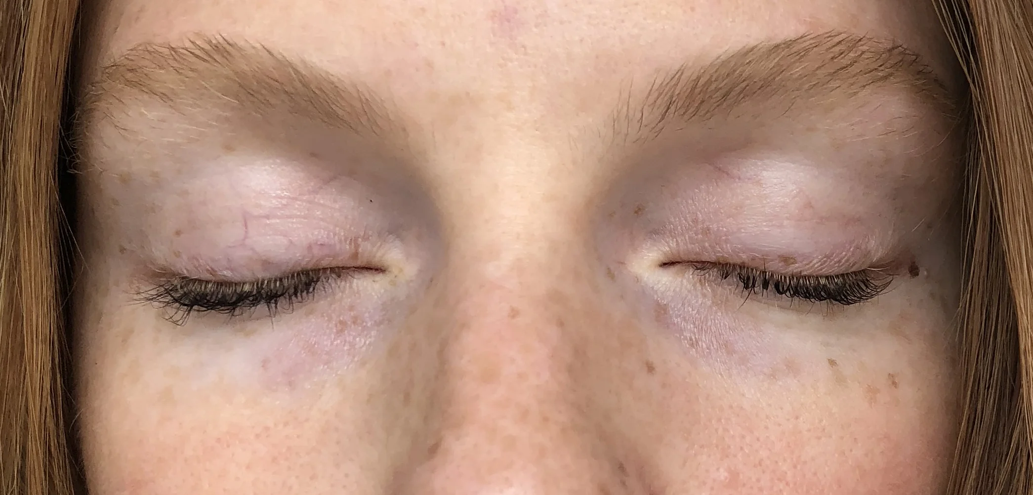Above is a close up of my eyes after using the VIICode Eye Cream for 3 weeks. I used it on my left (your right) eye only. 