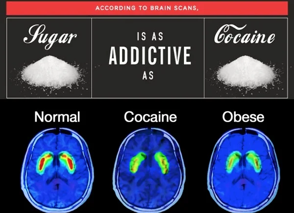 brain-on-sugar.jpg