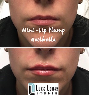 Mini+Lip+Plump.jpg